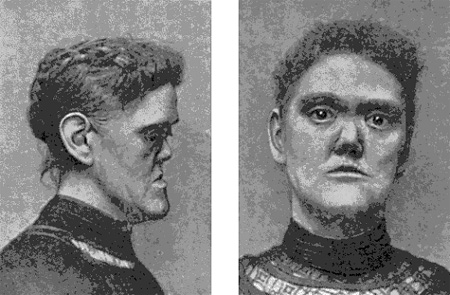 Syphilis AIDS pohlavní nemoci 05 Syphilis AIDS pohlavní nemoci 05